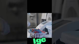 what is IGE immunoglobulin E IGE [upl. by Ronda]