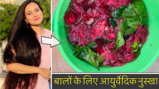 HAIR CHALLENGE  Ayurvedic Nuskha to Stop Hair Loss amp REGROW New Hair  100 Results [upl. by Larisa43]