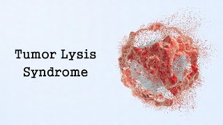 Tumor Lysis Syndrome Oncologic Emergencies [upl. by Justin455]