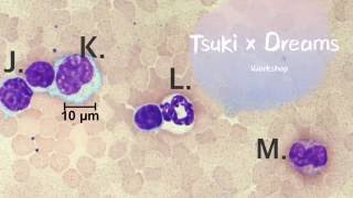 How To Do Differential White Blood Cell Count No Music [upl. by Farrow]