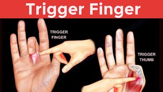 Trigger finger in Urdu Hindi Causes Symptoms and Physiotherapy treatment and Exercise [upl. by Thibaut]