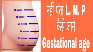 How to calculate  know Gestational age [upl. by Bethany]