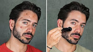 how to get clear skin for guys asap [upl. by Good]