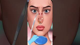 nose bone surgery animation 🇮🇳 nose doktor 🚑 part 2 3d jesus 1k quotes upsc art edit new [upl. by Lonergan]