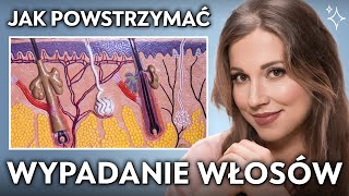 Wypadanie włosów  jak temu zapobiec 👩👦 [upl. by Helene]