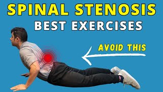 Best Exercises for Spinal Canal Stenosis Pain Relief [upl. by Jerrilyn]