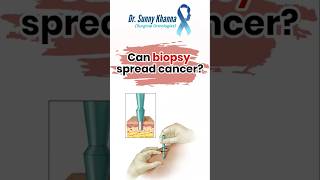 Can biopsy spread CANCER oncology cancer cervicalcancer biopsy [upl. by Dirrej]