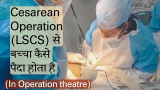 cesarean OperationLSCS kaise hota hai सिजेरियन डिलिवरी Step by Step Livelscs [upl. by Eatnuhs427]