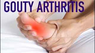 Gouty Arthritis [upl. by Laktasic534]