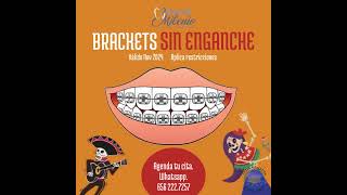 Brackets sin enganche [upl. by Aziar]