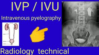 IVP  IVU  Intravenous pyelography  Radiology  Radiography  By BL kumawat [upl. by Tenrag]