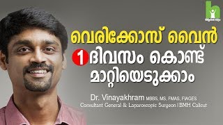 വെരികോസ് വൈൻ മാറ്റാൻ 2 വഴികൾ  varicose veins malayalam health tips [upl. by Ardnaed]