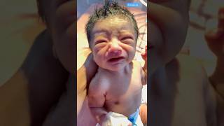 Newborn babies crying medical viralvideo [upl. by Eitsyrhc]