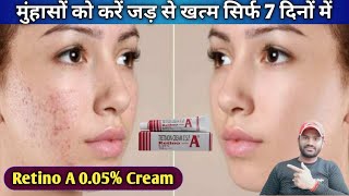 Retino A 005 Cream use dose benefits and side effects full review in hindi [upl. by Vokaay]