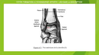 Ligament tibiofibulaire antéroinférieur en échographie [upl. by Ainitsirc]