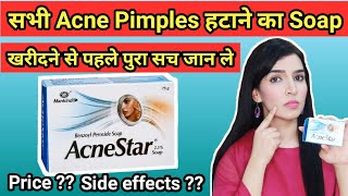 Acnestar soap Review  Acnestar Soap for Acne Pimples  Detailed review Uses Benefits [upl. by Ashwell]