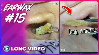 EP 15 Earwax ASMR Earwax removal video will make you relax Keep your ears clean [upl. by Ilonka]