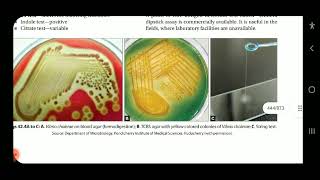 Apurba S Sastry Microbiology Cholera Halophilic vibrio amp aeromonas infections part 2 [upl. by Jeroma]