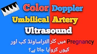 Umbilical Artery Doppler Ultrasound  Color Doppler scan in Pregnancy  IUGR  pregnancy sonography [upl. by Ransom]