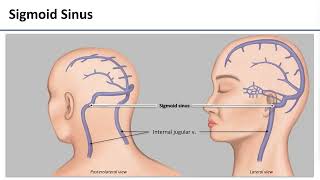 LO6 Dural Venous Sinuses [upl. by Dnomyaw]