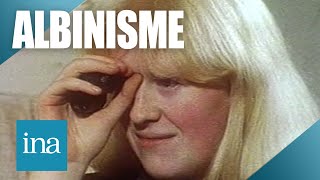 1988  Être albinos en France  Archive INA [upl. by Ewer]