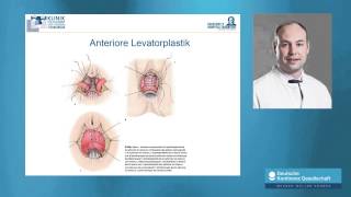 N Habbe Stuhlinkontinenz  Diagnose Risiken und Therapien [upl. by Eiuqnom357]