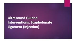 Ultrasound Guided Interventions Scapholunate Ligament Injection [upl. by Suzie]