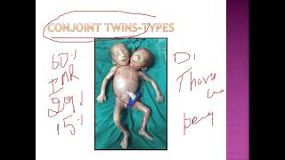 Twinning drchitrashumananatomy [upl. by Naitsirc]