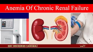 Lecture 163 Anemia of Chronic Renal Failure [upl. by Ynaffik]