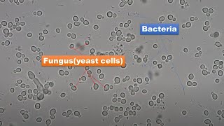 Bacteria and Fungus Microscopy at Various magnifications 400X 800X and 1600X [upl. by Amesari422]