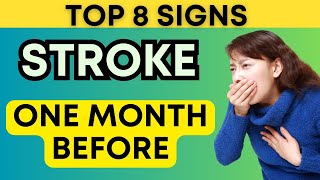 Top 10 Warning Signs of Stroke One Month Before It Occurs [upl. by Eniamret]