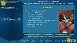 Percutaneous Endoscopic Gastrostomy Gastrostomy with Jejunal Extension [upl. by Tratner]