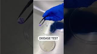 Oxidase Reaction Test  Disc Oxidase Test  Positive Oxidase Reaction microbiology youtubeshorts [upl. by Ahsilram275]