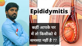 Epididymitis हिंदी में  Explained by K Amitesh singh [upl. by Edie]