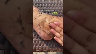 Deep Cleansing Remove Dust and Dead Skin ameenbeautytips GlowAndCleanByAmeen [upl. by Hashim]