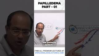 Papilledema Part 01 drnajeeb drnajeeblectures youtubeshorts [upl. by Mirak423]