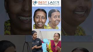 இம்பிளாண்ட் இவ்வளோ ஈஸியா Painless full teeth immediate dental implants at Chennai dentalimplants [upl. by Yahc659]