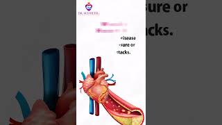 Congestive Heart Failure Causes Symptoms and Treatment Options  Dr Sudheer Koganti shorts [upl. by Lesirg271]