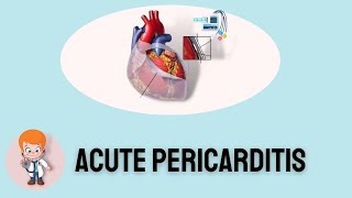 ECG Features of Acute Pericarditis [upl. by Souvaine]