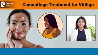 NEW VITILIGO TREATMENTCamouflage Treatment for Vitiligo Skin ColourDrAmee DaxiniDoctors Circle [upl. by Monro341]