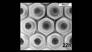 Mesenchymal Stem Cell spheroid formation time lapse [upl. by Ynavoj166]