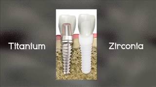 The Zirconia Implant amp Natural Dentistry by Behm [upl. by Htebiram429]