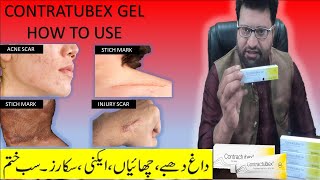 contractubex gel review  Acne scar removal cream  contractubex gel how to use  scar treatment gel [upl. by Dorinda]