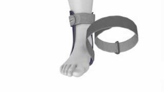 Bauerfeind MalleoLoc® Ankle Brace [upl. by Aniz]