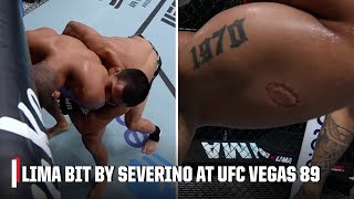 Igor Severino DQ’d for biting Andre Lima on UFCVegas89 prelims  ESPN MMA [upl. by Ronen]