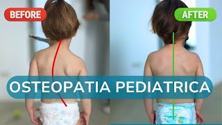 VALUTAZIONE POSTURALE OSTEOPATICA dei BAMBINI IN CRESCITA  osteopatia pediatrica by DrSilva [upl. by Yraht378]