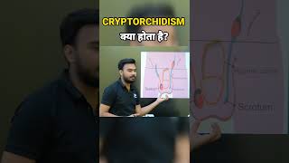 What Is Cryptorchidism  नपुंसकता कैसे होती है  shorts cryptorchidism biology xpclasses [upl. by Scarface]