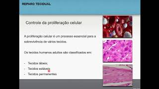 Reparo tecidual  Patologia geral 15 [upl. by Berke]