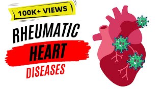 Rheumatic heart disease  Rheumatic fever [upl. by Selway]