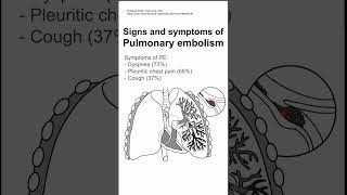 Signs and symptoms of Pulmonary embolism [upl. by Llewxam]